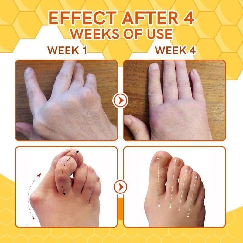 Furzero Soothing Leg Spray with Bee Venom Extract (Pack of 2)