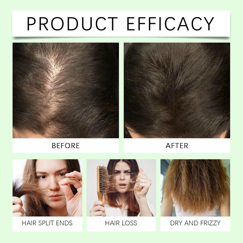 (BUY 1 GET 1 FREE) BATANA® Original Oil Shampoo with Rosemary Extract