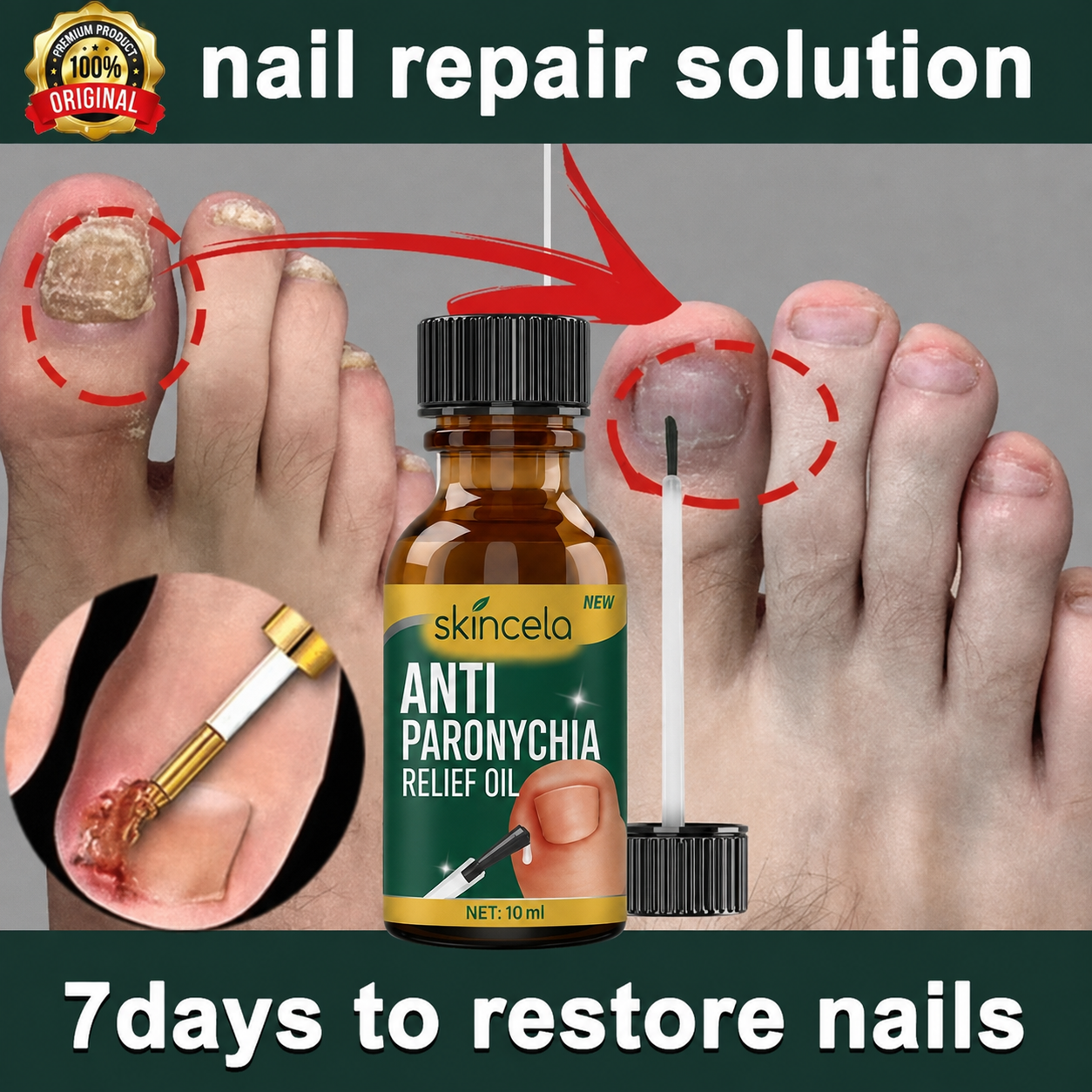 (BUY 1 GET 1 FREE) Skincela® - Magic Nail Anti-Paronychia Relief Oil