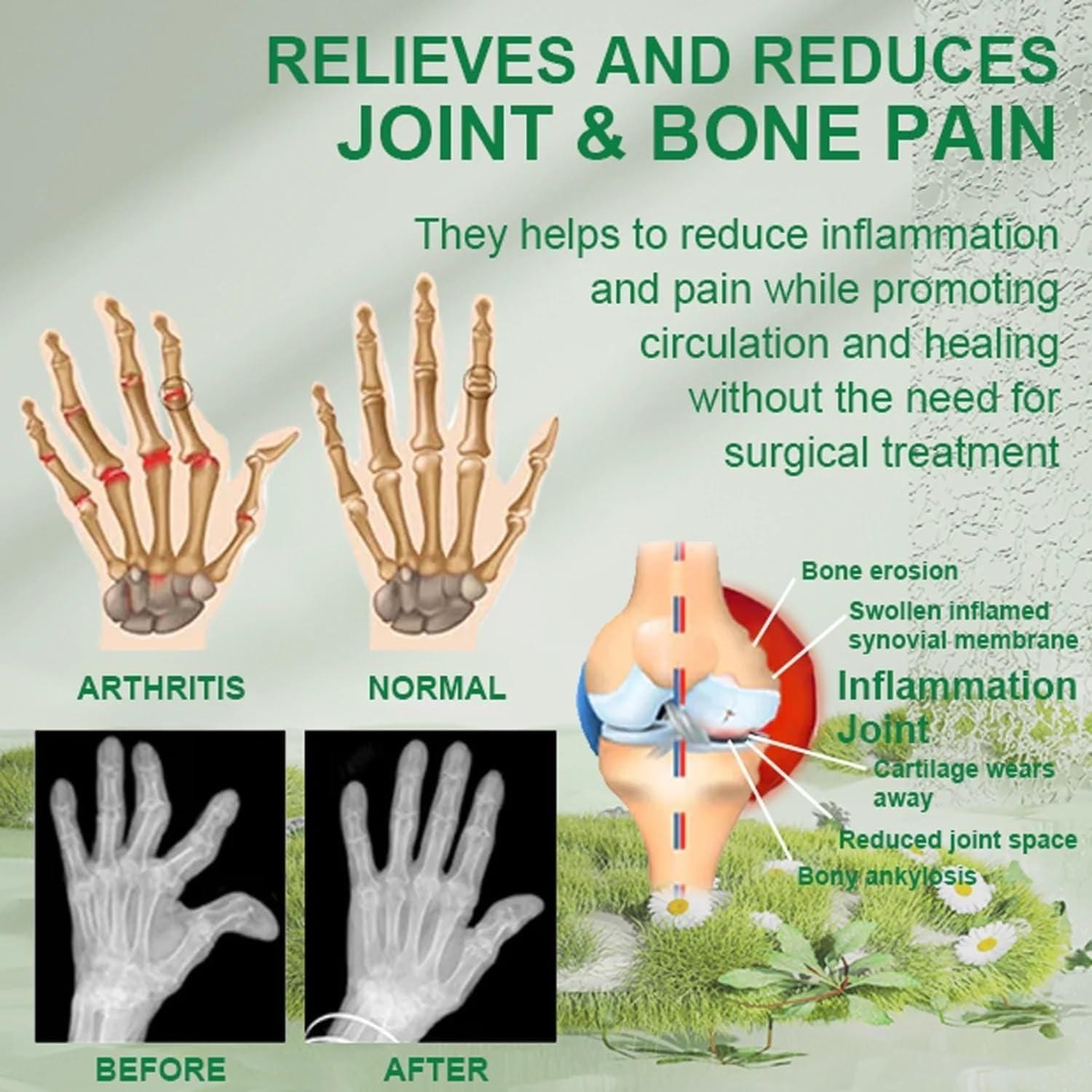 Bee Venom Joint and Bone Care Cream (Pack of 3)