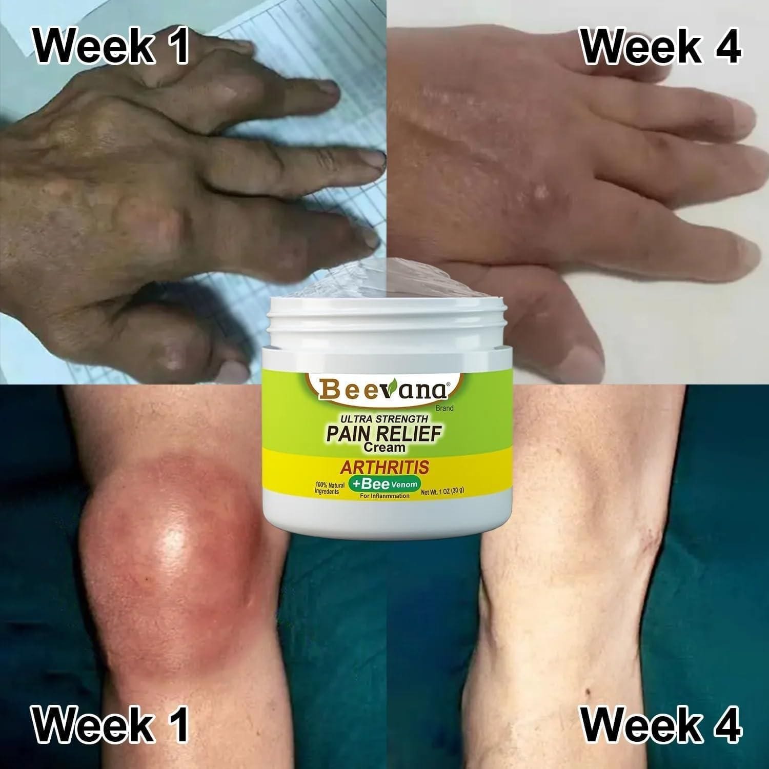 Bee Venom Joint and Bone Care Cream (Pack of 3)