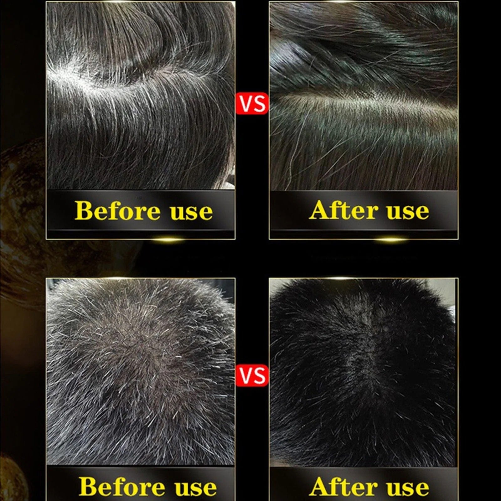 (BUY 1 GET 1 FREE) EverBlack® - 3 in 1 Natural Black Hair Dye Shampoo