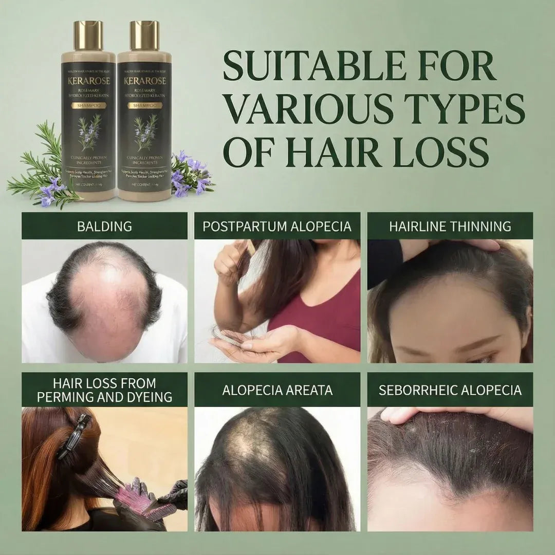 (BUY 1 GET 1 FREE) Kerarose® - Magic Rosemary Hair Growth Shampoo