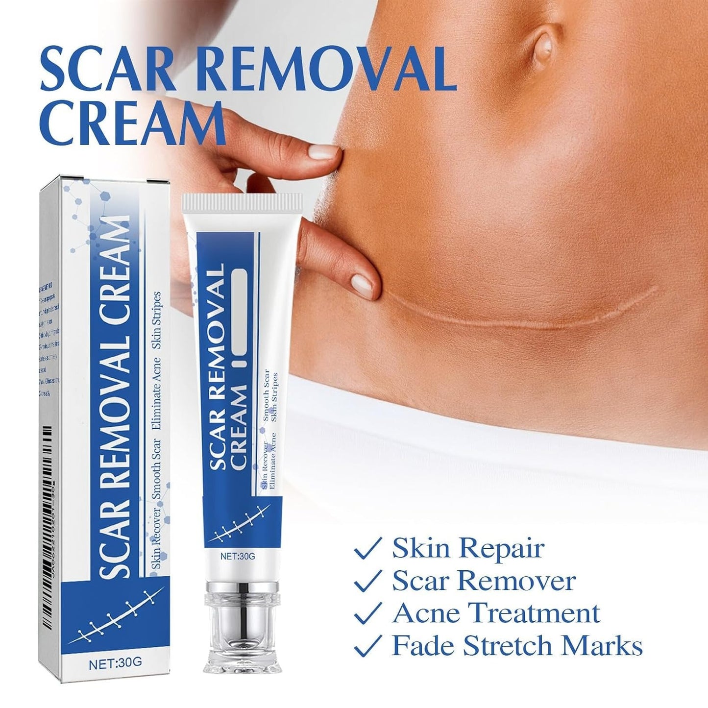 (BUY 1 GET 1 FREE) ScarAway® - Scar Removal Cream 100g
