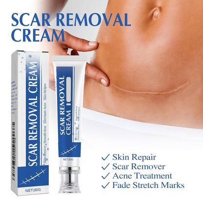 (BUY 1 GET 1 FREE) ScarAway® - Scar Removal Cream 100g