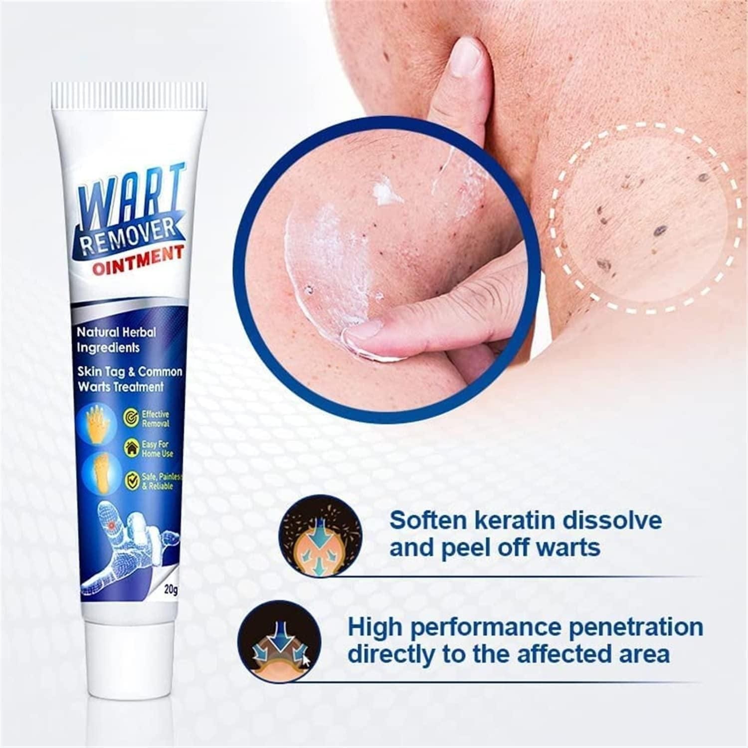Wart Care Cream (Pack of 2)
